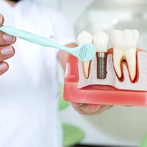 Dental implant treatment